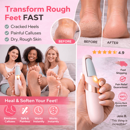 Urveso Callus Remover Pro - Urveso